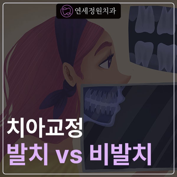 발치교정과 비발치교정, 나에게 맞는 방법은? 관련 이미지 1