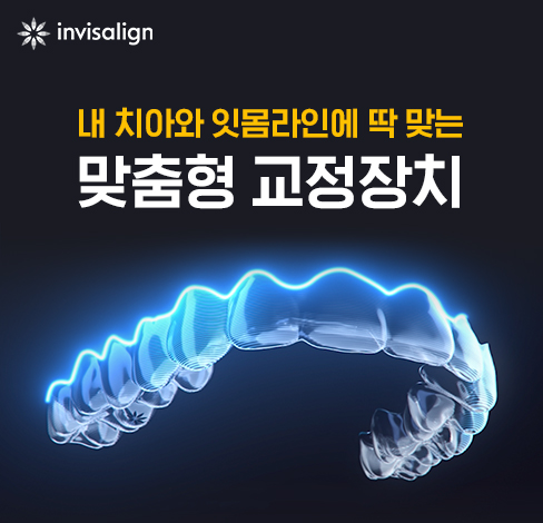 인비절라인 투명교정 비용, 연세정원치과 관련 이미지 2