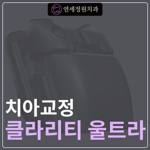 클라리티 울트라 (Clarity Ultra SL) 치아교정 관련 이미지 1