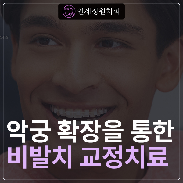 악궁확장을 통한 발치 없는 교정치료 관련 이미지 1
