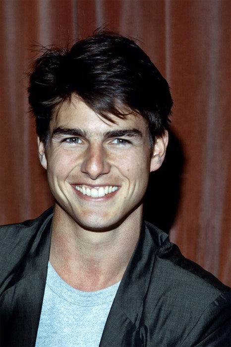 치아 중심선이 안 맞아요! 치아 비대칭 교정으로 가능할까요? @ 대치동 교정치과 연세정원치과 관련 이미지 4