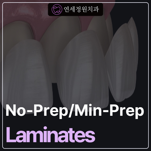 Non-Prep and Minimal-Prep Veneers in Seoul&ndash; Costs & What to Expect 관련 이미지 1