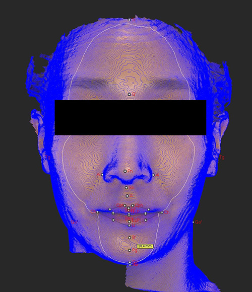 대치동교정치과에서 정밀진단은 어떤 건가요? 연세정원치과 관련 이미지 12
