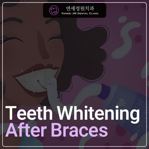Teeth Whitening After Orthodontic Treatment at Yonsei JW Dental Clinic image 1