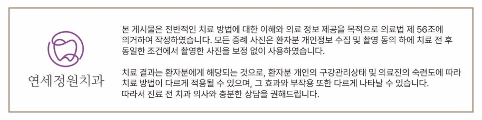 원데이 치아미백의 순서 @ 대치동 치아미백 연세정원치과의원 관련 이미지 21