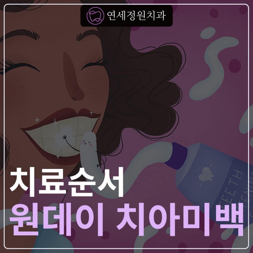원데이 치아미백의 순서 @ 대치동 치아미백 연세정원치과의원 관련 이미지 1