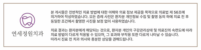 치아 중심선 비대칭 및 개방교합 교정, 대치동 연세정원치과 관련 이미지 16