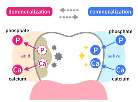 Teeth Whitening After Orthodontic Treatment at Yonsei JW Dental Clinic image 6