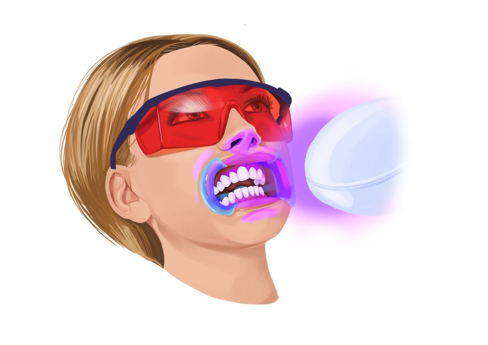 Precautions for Teeth Whitening Treatment @ Yonsei JW Dental Clinic 관련 이미지 5