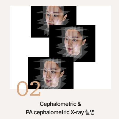 대치동치아교정은 연세정원치과 관련 이미지 6