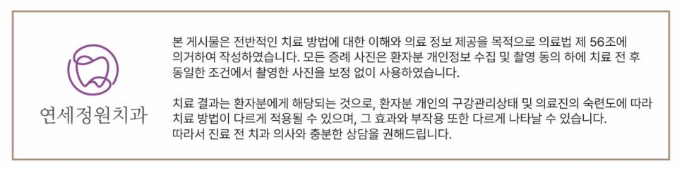 과개교합과 손상된 앞니, 심미와 기능을 함께 회복한 앞니 심미보철 케이스 관련 이미지 15