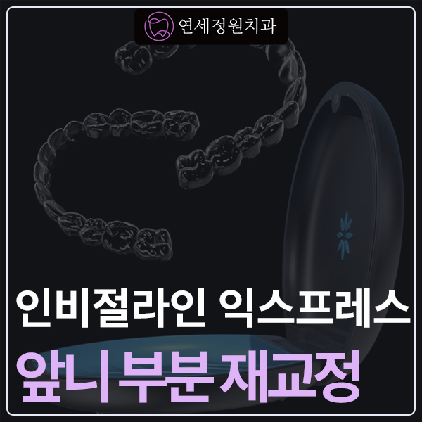 인비절라인 익스프레스 부분교정 <앞니 재교정> 관련 이미지 1
