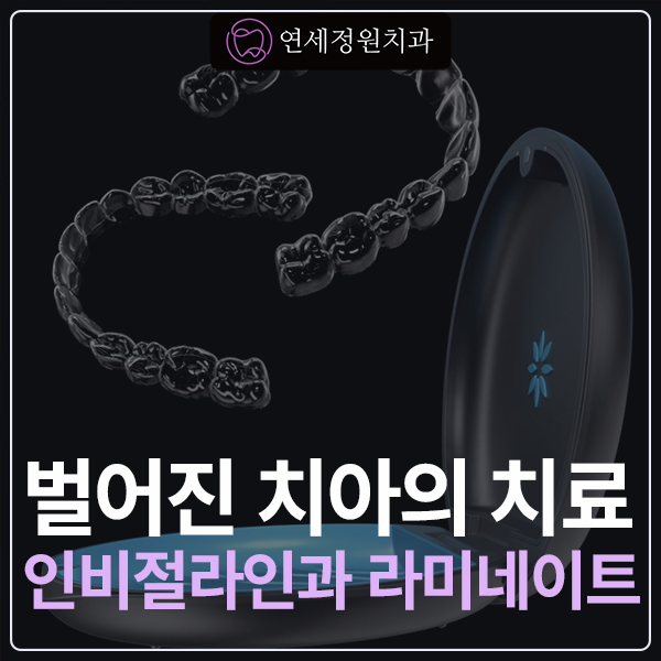 앞니 벌어짐과 왜소치, 하악 앞니 공간을 인비절라인 라이트와 라미네이트로 개선한 증례 관련 이미지 1