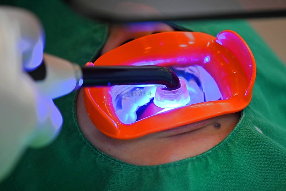 One Day Teeth Whitening Process @ Yonsei JW Dental Clinic 관련 이미지 12