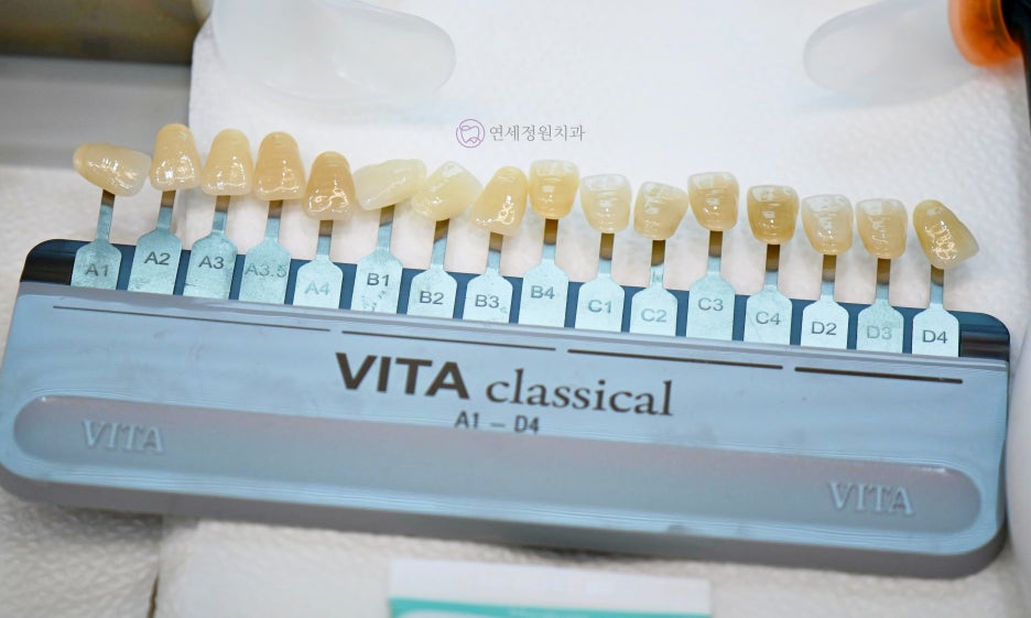 One Day Teeth Whitening Process @ Yonsei JW Dental Clinic 관련 이미지 7