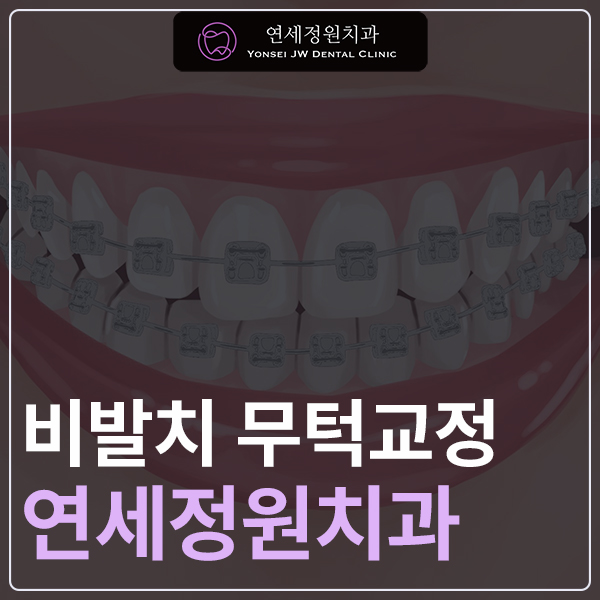 대치동 교정치과 비발치 무턱 교정 관련 이미지 1
