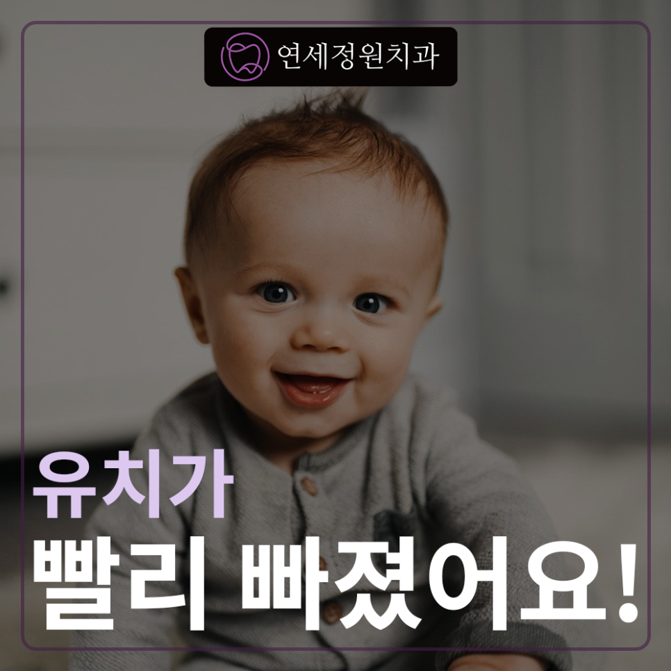 유치가 빨리 빠졌어요, 대치동소아치과 연세정원치과 관련 이미지 1