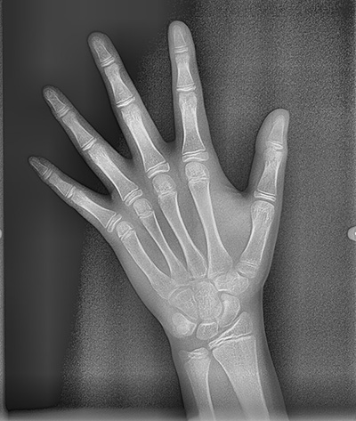 대치동교정치과에서 정밀진단은 어떤 건가요? 연세정원치과 관련 이미지 7