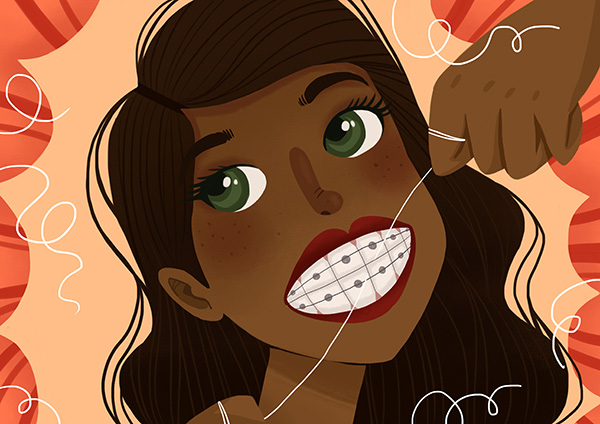 치아교정 이후 유지장치는 언제까지 하나요? 관련 이미지 4