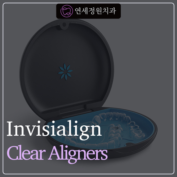 Types and Features of Invisalign Clear Aligners image 1