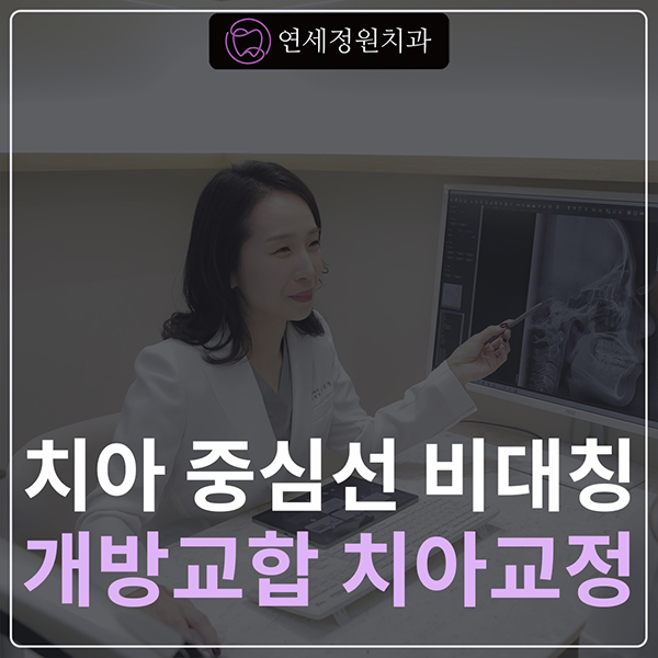 치아 중심선 비대칭 및 개방교합 교정, 대치동 연세정원치과 관련 이미지 1