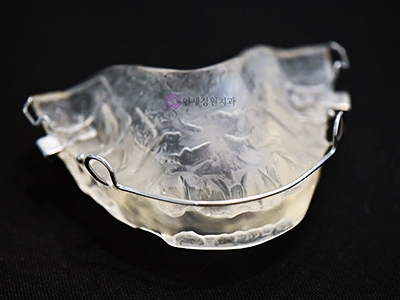 어린이 무턱 액티베이터 성장교정 후 인비절라인 퍼스트 관련 이미지 6