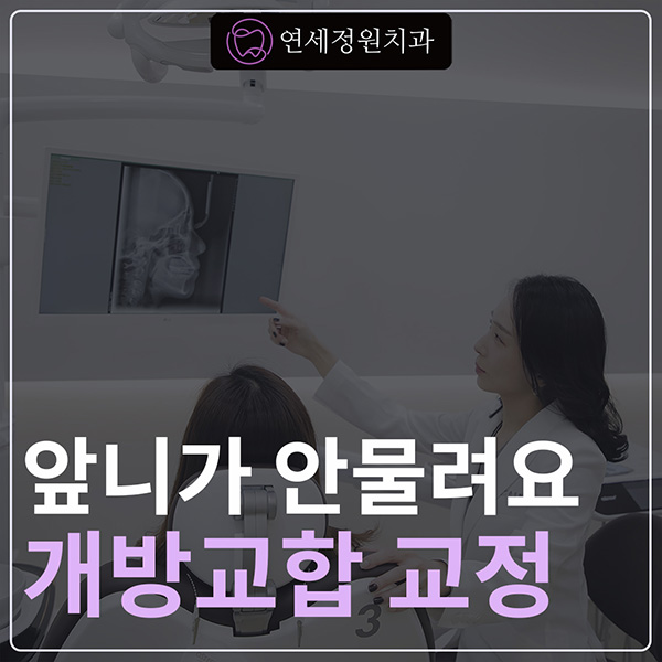 앞니가 안 물려요! 개방교합(openbite) 치아교정 전후 및 후기 관련 이미지 1