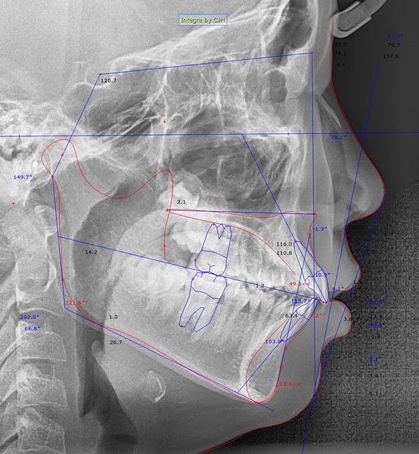 대치동교정치과에서 정밀진단은 어떤 건가요? 연세정원치과 관련 이미지 4