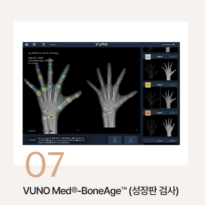 대치동치아교정은 연세정원치과 관련 이미지 11