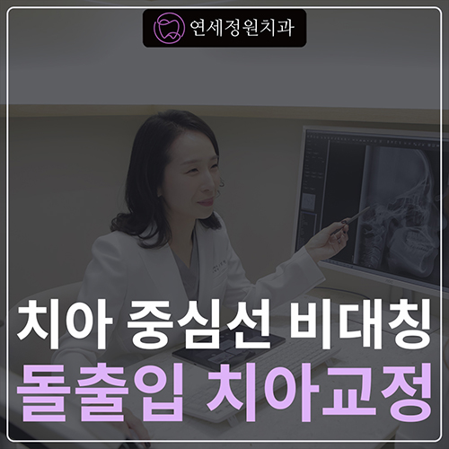 비대칭 및 돌출입 치아교정, 대치동 교정치과 연세정원치과 관련 이미지 1