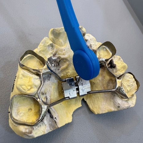 악궁확장장치(RPE, MARPE, MSE) 돌리는 방법 관련 이미지 10