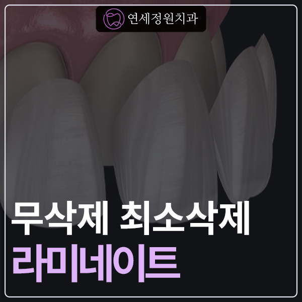 대치동 무삭제, 최소삭제 라미네이트 비용 관련 이미지 1