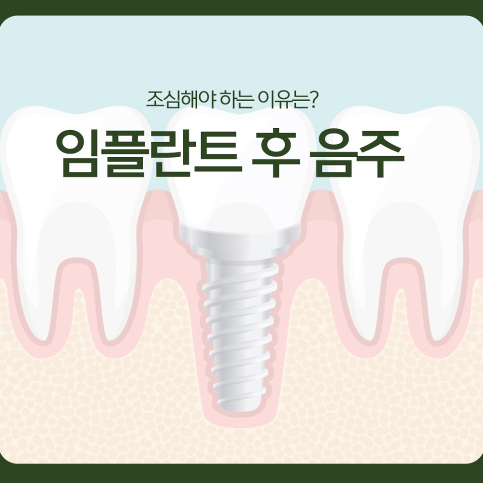 Why Should You Be Careful About Drinking After an Implant? image 1