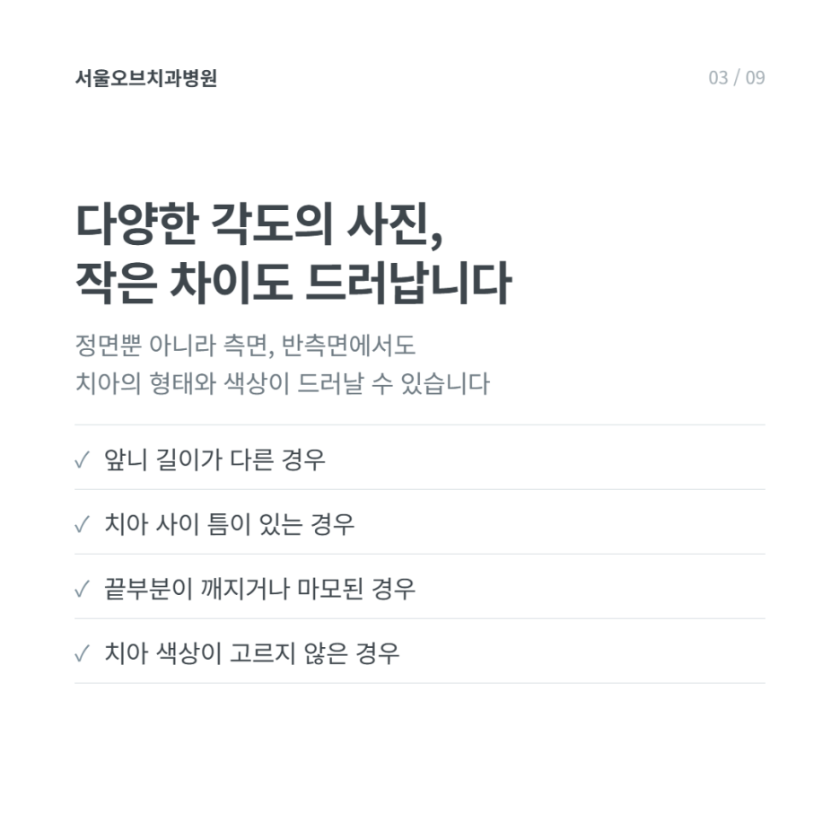 웨딩촬영 앞둔 예비 신랑, 오브제로라미네이트(모먼트)를 선택한 이유 관련 이미지 8