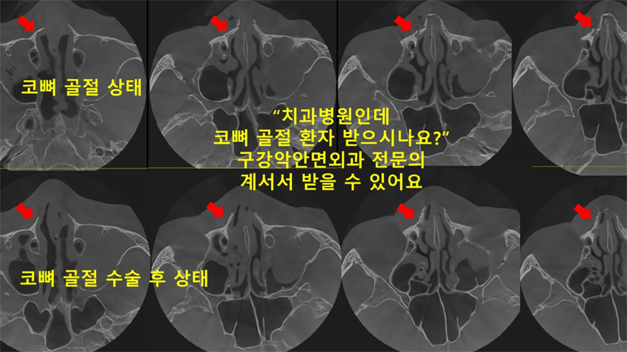 In Unexpected Dental Trauma, There Is a Hospital That Can Respond Immediately image 2