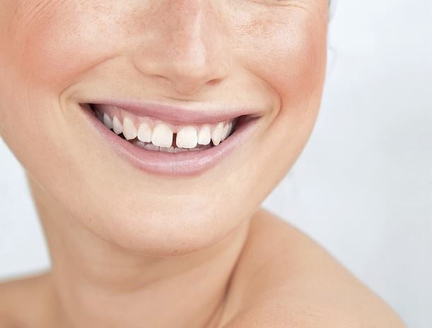 From Cavities to Chipped Front Teeth, Fast and Natural! image 7