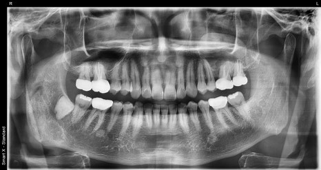 Clicking in the Jaw? A TMJ Treatment Clinic with an Oral and Maxillofacial Surgeon from Seoul National University image 2