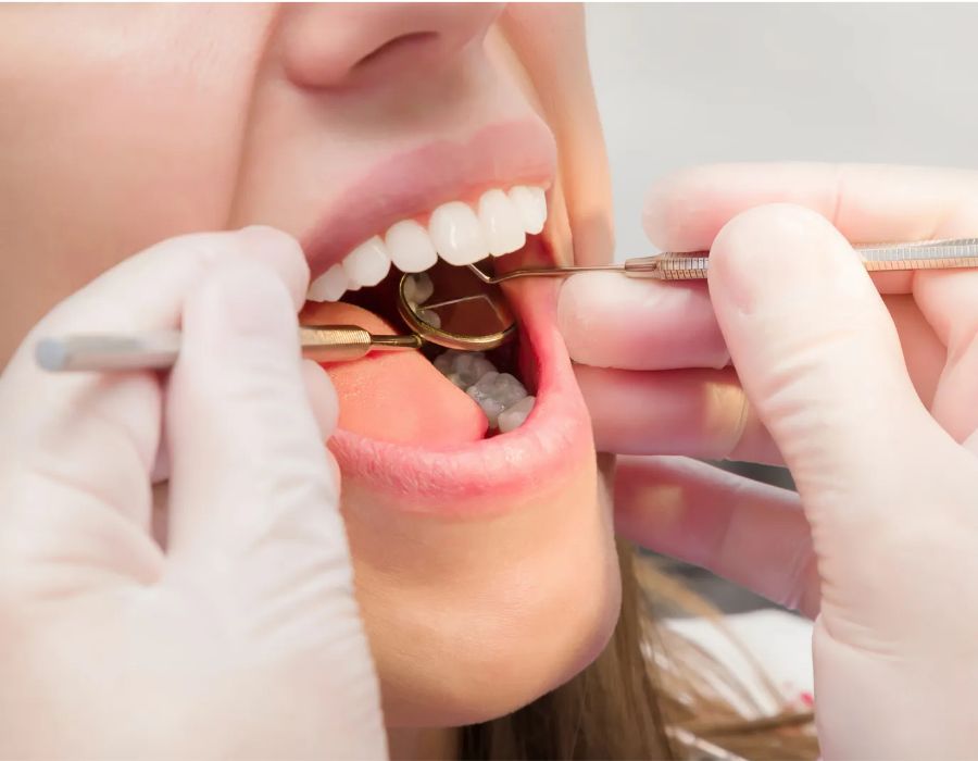 Gum Care Methods: The First Step to Protecting Your Teeth image 5