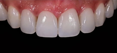 Objeo Laminate Price, and How It Differs from No-Prep Laminate image 9