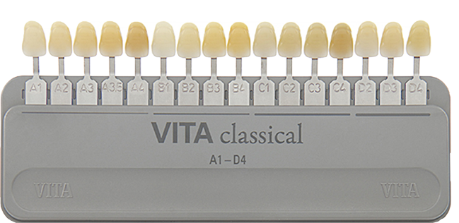 Jamsil Teeth Whitening: Can You See Results in Just One Day? image 8