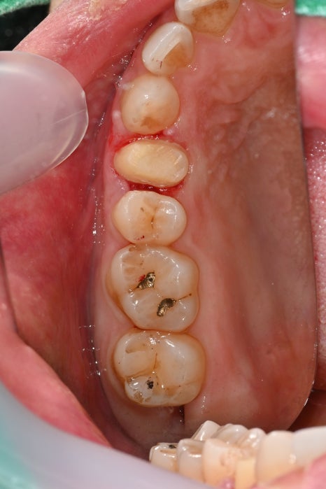 Found a Dental Clinic That Can See Patients on Sundays! Convenient for Patients with Rhinitis and Asthma image 5