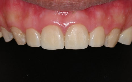 [Seokchon Station Dental Clinic] Overcoming Dental Phobia with Evening and Sunday Treatment! image 11