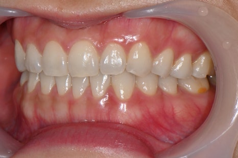 OVZERO Laminate: What Makes It Different? image 8