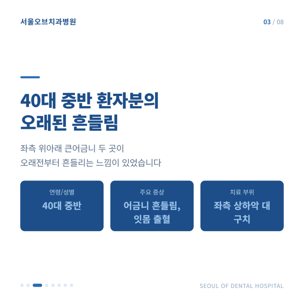 잠실임플란트 치주염으로 흔들리던 어금니, 오스템임플란트 수복 사례 관련 이미지 4