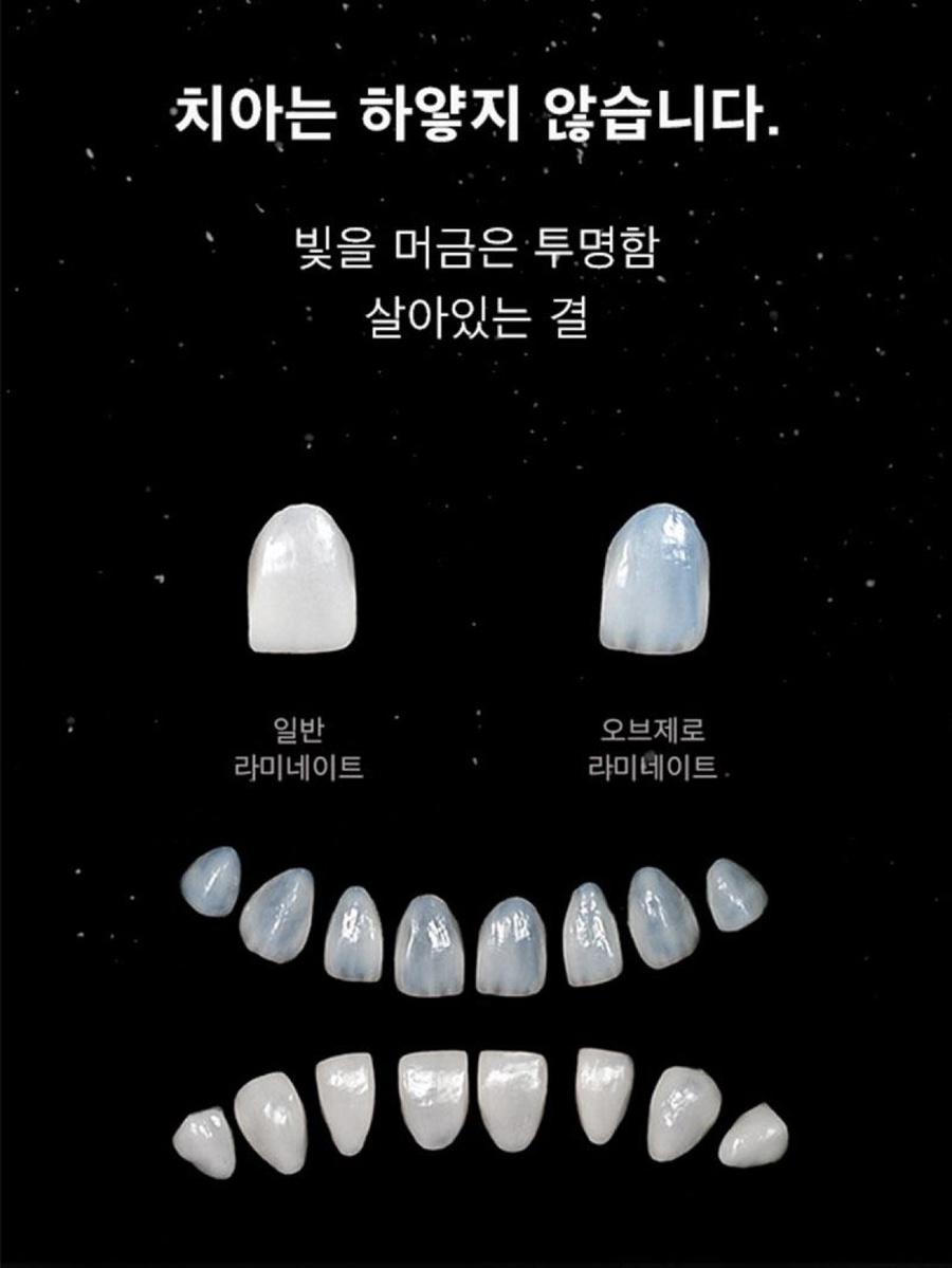 Jamsil Laminate: Cases Where Treating Just a Few Front Teeth Is Enough image 6