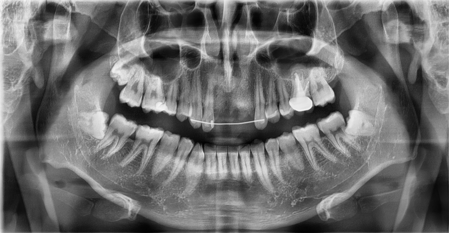 Recommended Ways to Get Hospital Treatment and Compensation After a Traffic Accident image 8