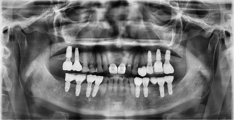 Recommended Ways to Get Hospital Treatment and Compensation After a Traffic Accident image 3