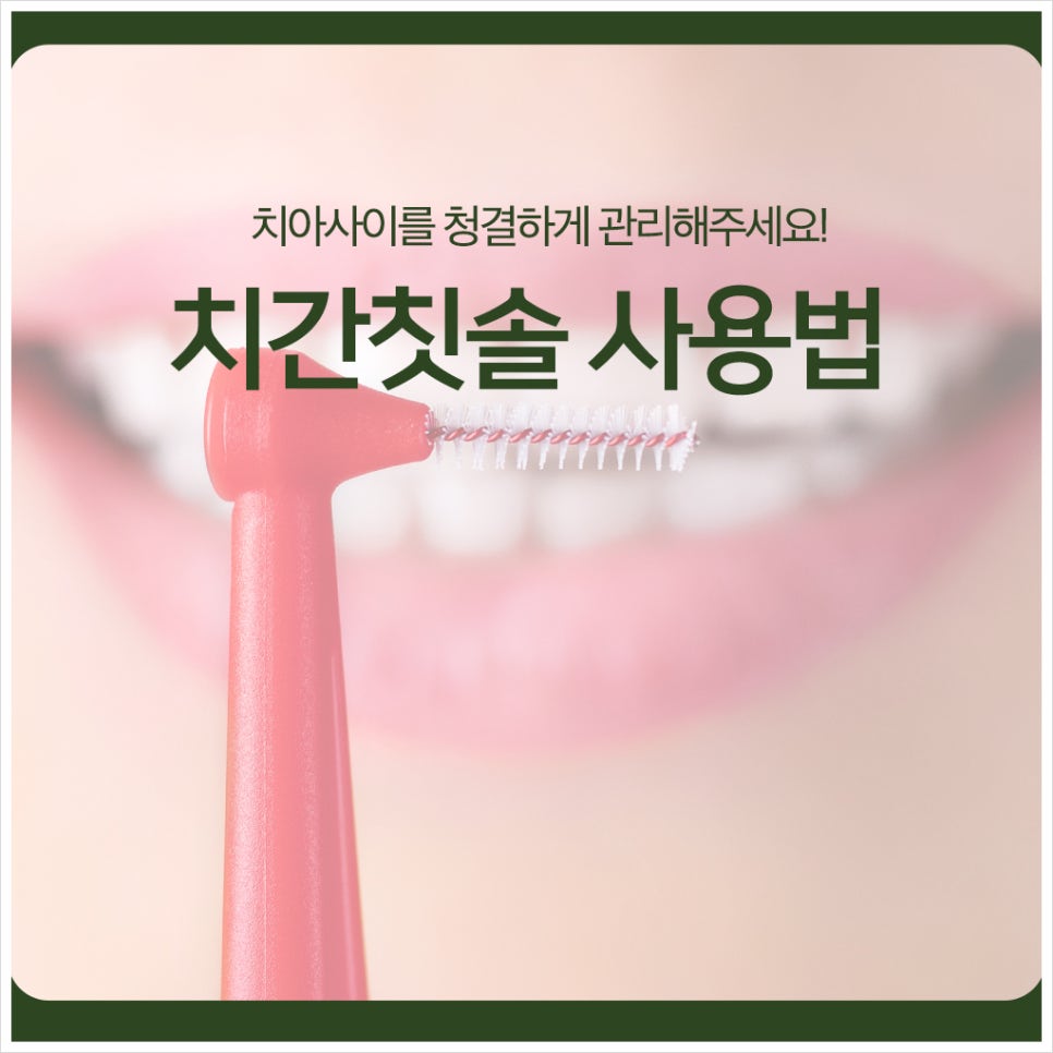 치간칫솔 사용법, 치아사이를 청결하게 관리해주세요! 관련 이미지 1