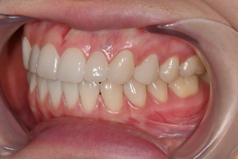 OVZERO Laminate: What Makes It Different? image 11