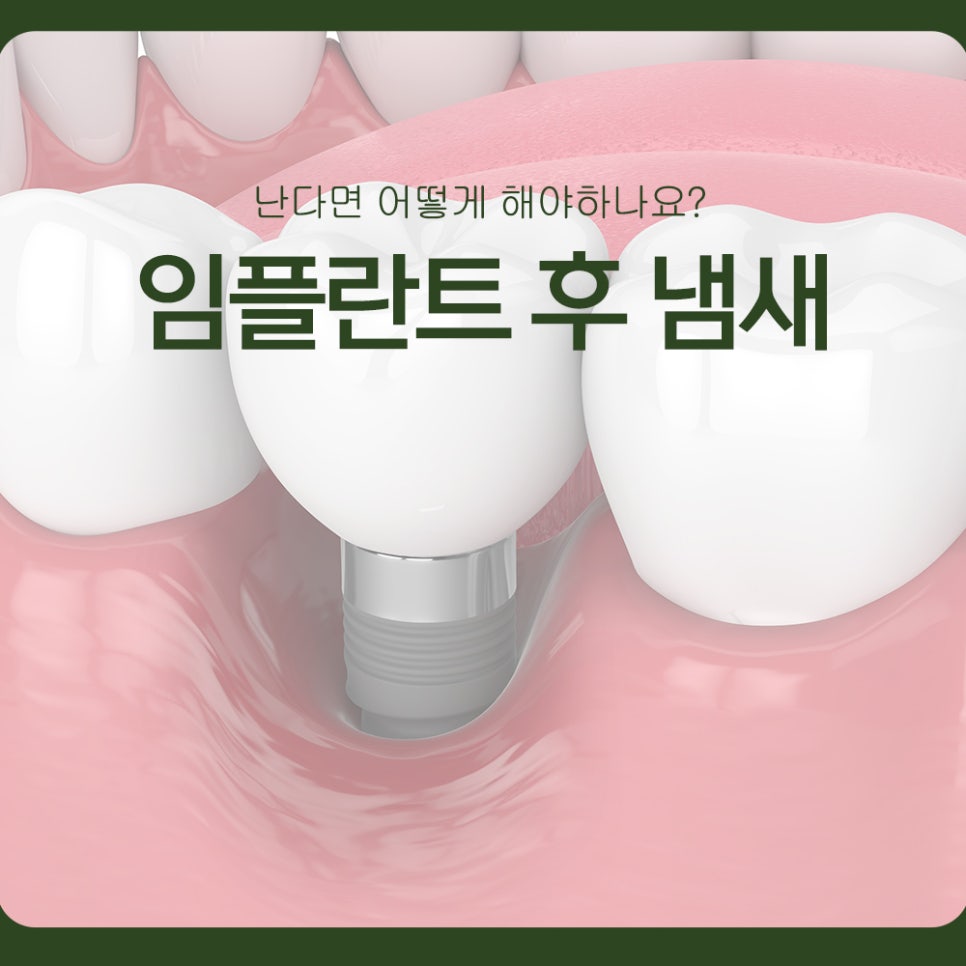 What Should You Do If You Notice Odor After an Implant? image 1